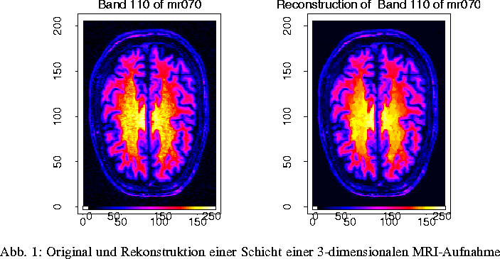 \Projektbild {.9\textwidth}{mr070_110.ps}{Original und Rekonstruktion einer 
 Schicht einer 3-dimensionalen MRI-Aufnahme
}
