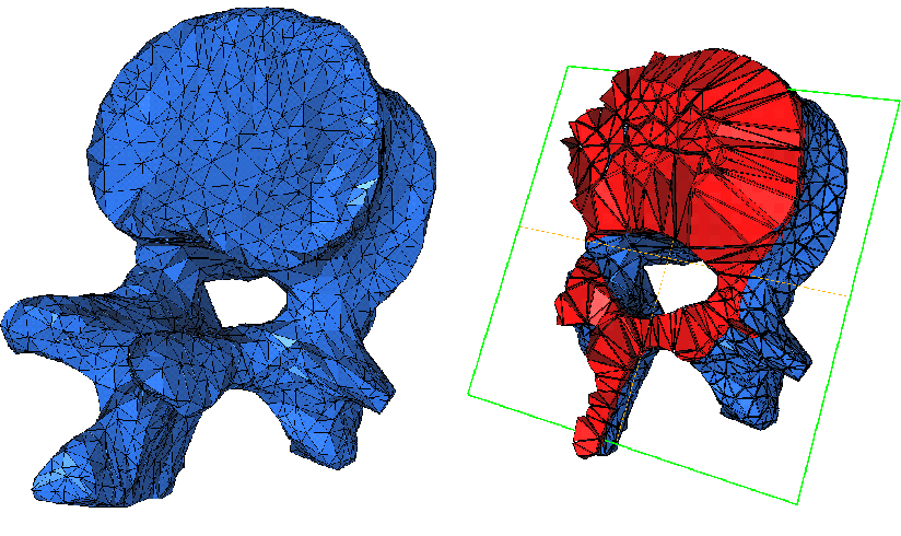 \makeatletter
\@ZweiProjektbilderNocap[h]{0.45\textwidth}{spine-full.eps.gz}{spine-split.eps.gz}
\makeatother
