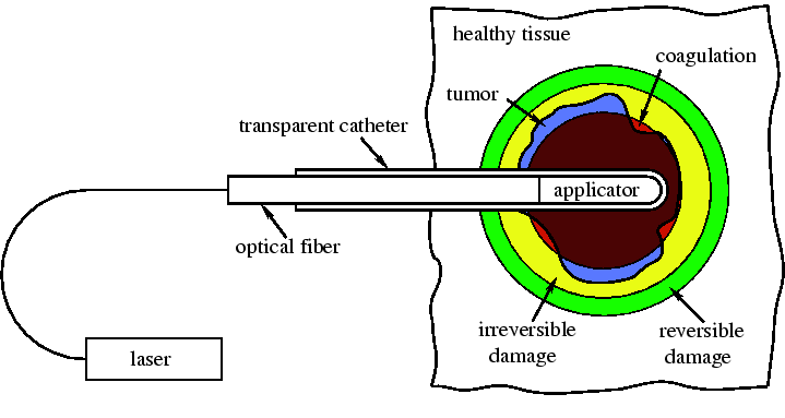 \ProjektEPSbildNocap{0.8\textwidth}{hoemberg_fig4_03.eps}