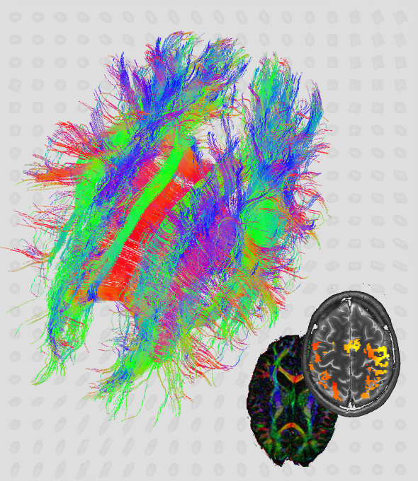 Brain Tethaedron Mesh